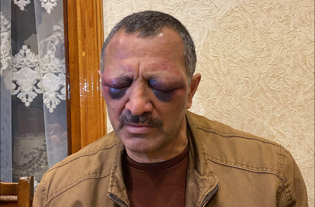 двойных стандартах