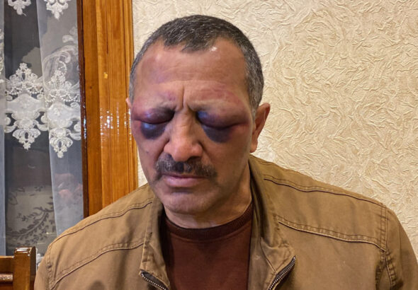 двойных стандартах