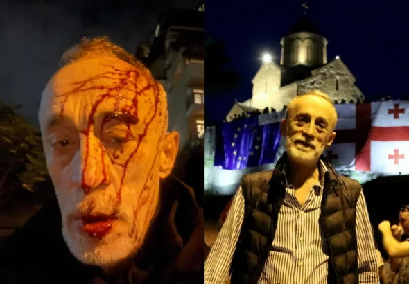 В Тбилиси избит